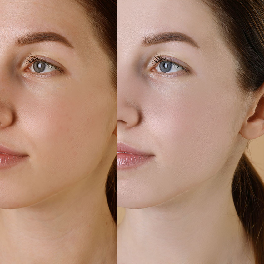Colour-correct as you prep